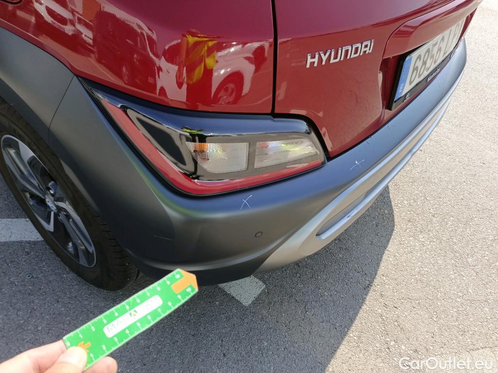  Hyundai  Konna Kona Tecno Hybrid 2WD 1.6 GDI 105CV E6d #17