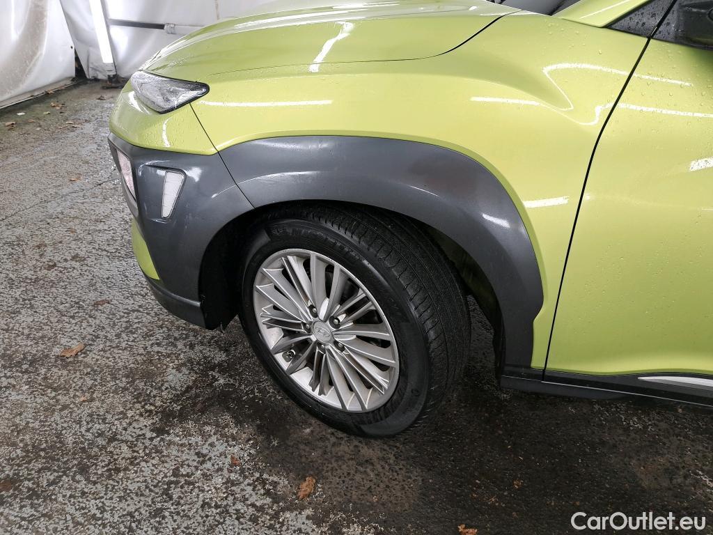  Hyundai  Konna HYUNDAI Kona / 2017 / 5P / SUV 1.6 CRDI 136 DCT-7 Creative / VO RECONDITIONNE - PHOTOS AVANT RECONDITIONNEMENT #6