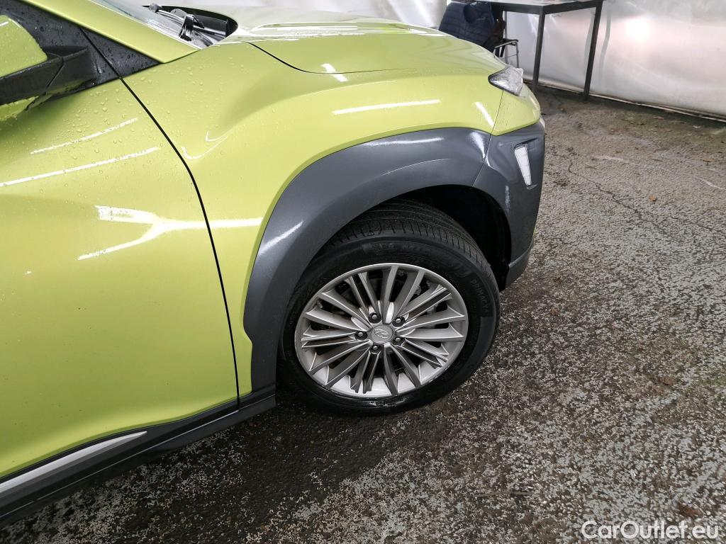  Hyundai  Konna HYUNDAI Kona / 2017 / 5P / SUV 1.6 CRDI 136 DCT-7 Creative / VO RECONDITIONNE - PHOTOS AVANT RECONDITIONNEMENT #12
