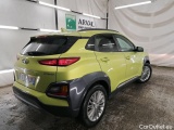  Hyundai  Konna HYUNDAI Kona / 2017 / 5P / SUV 1.6 CRDI 136 DCT-7 Creative / VO RECONDITIONNE - PHOTOS AVANT RECONDITIONNEMENT #3